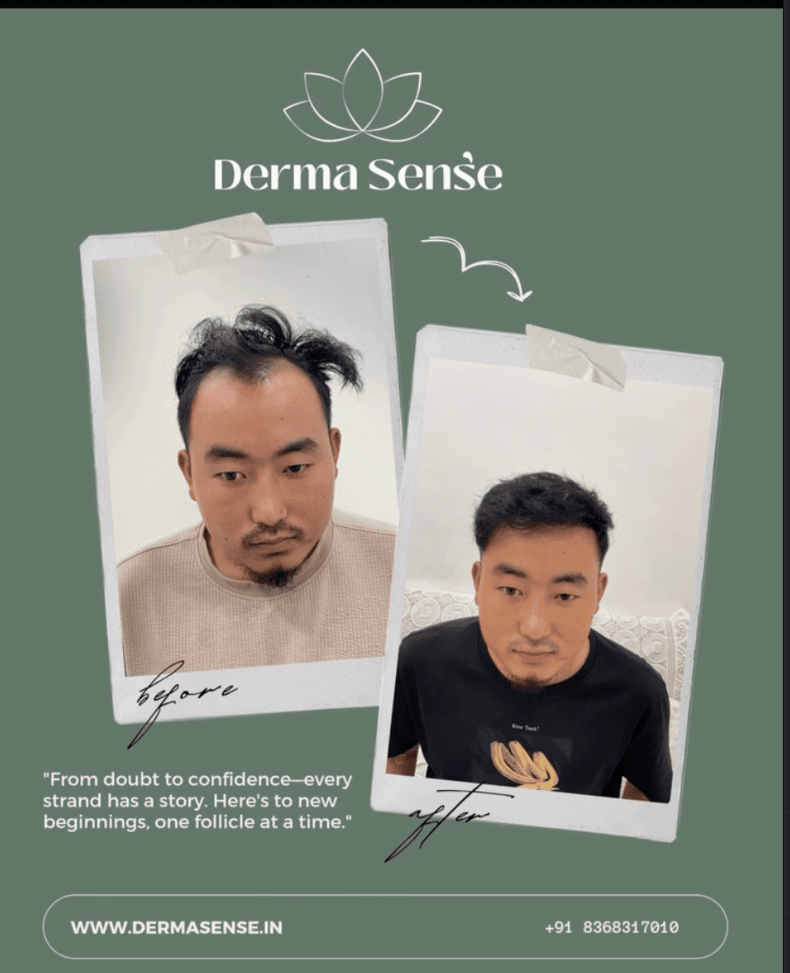 Client before and after