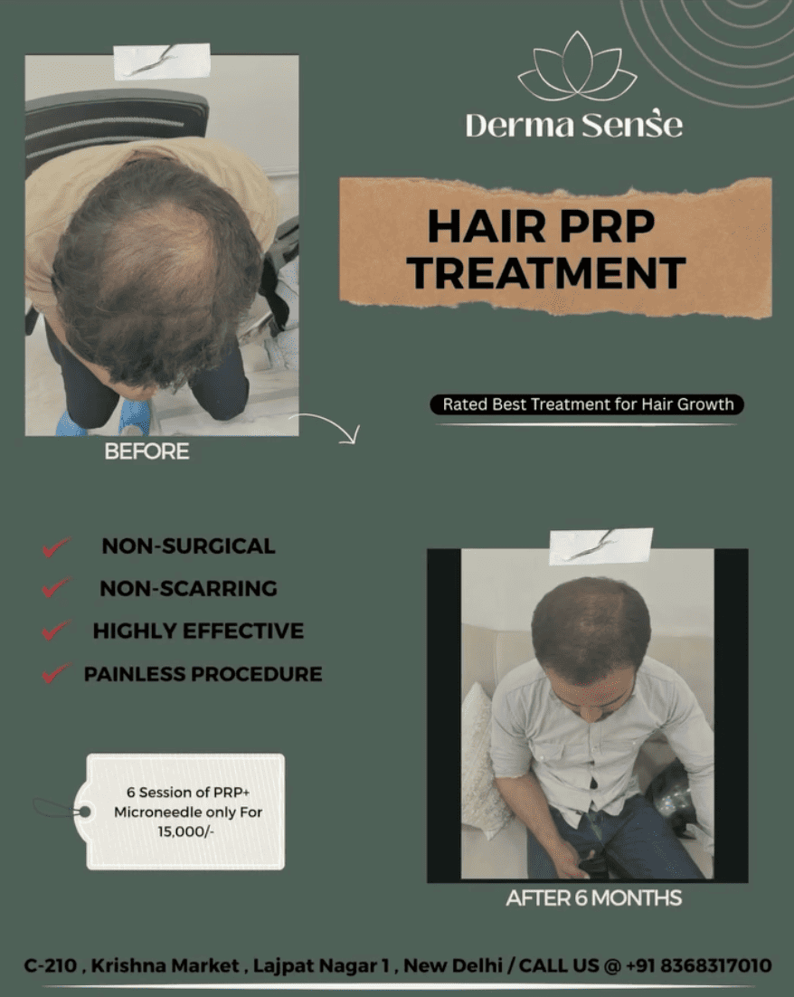 Client before and after
