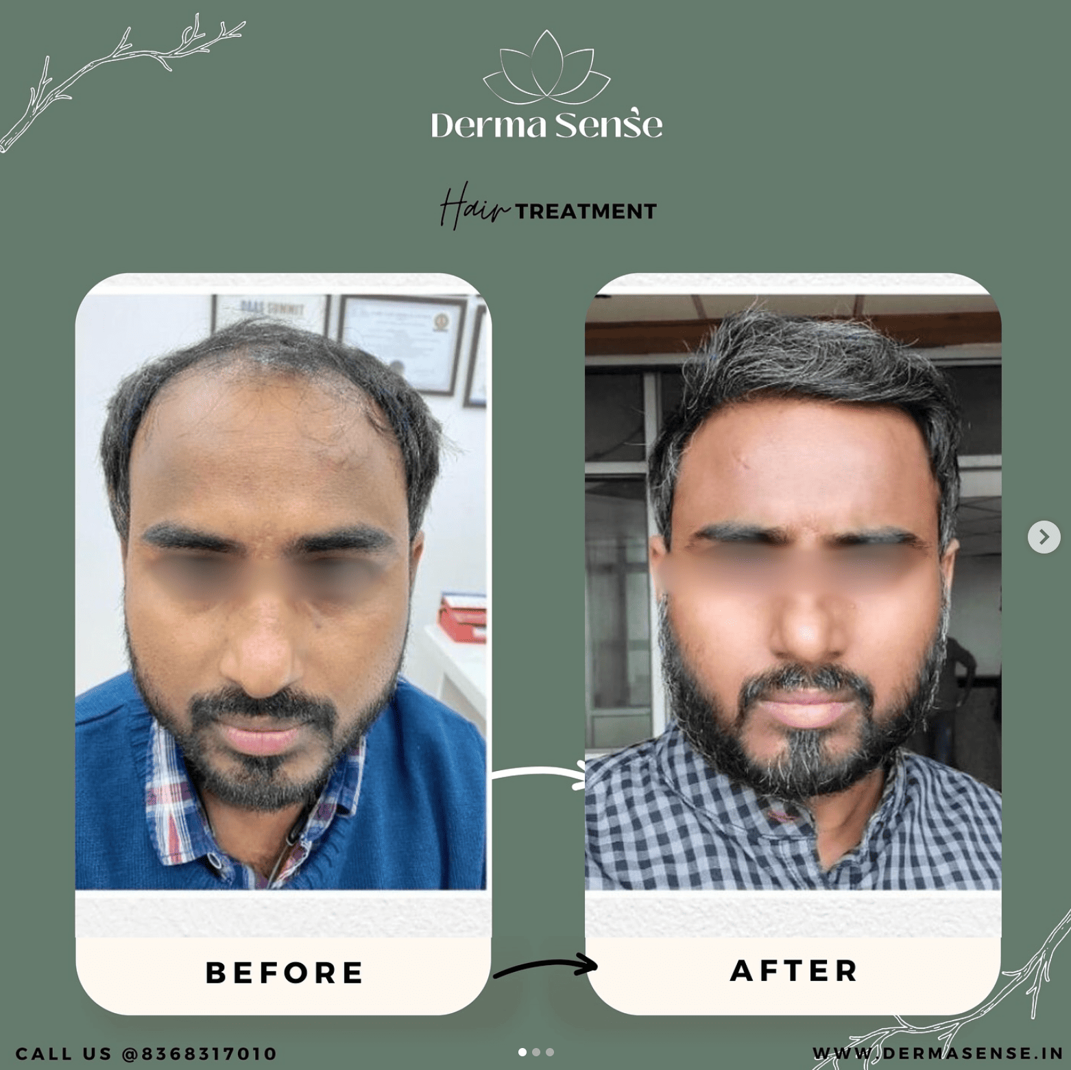 Client before and after