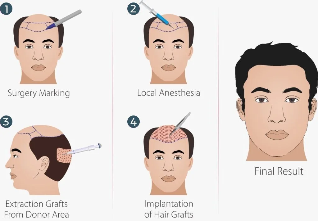 How It Works?