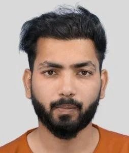 Hair transplant result