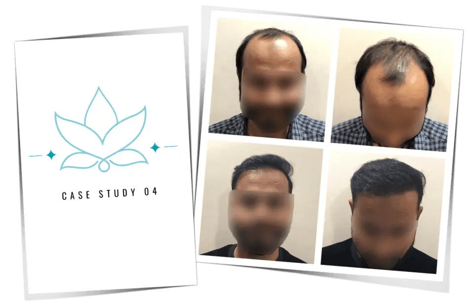 Patient case study