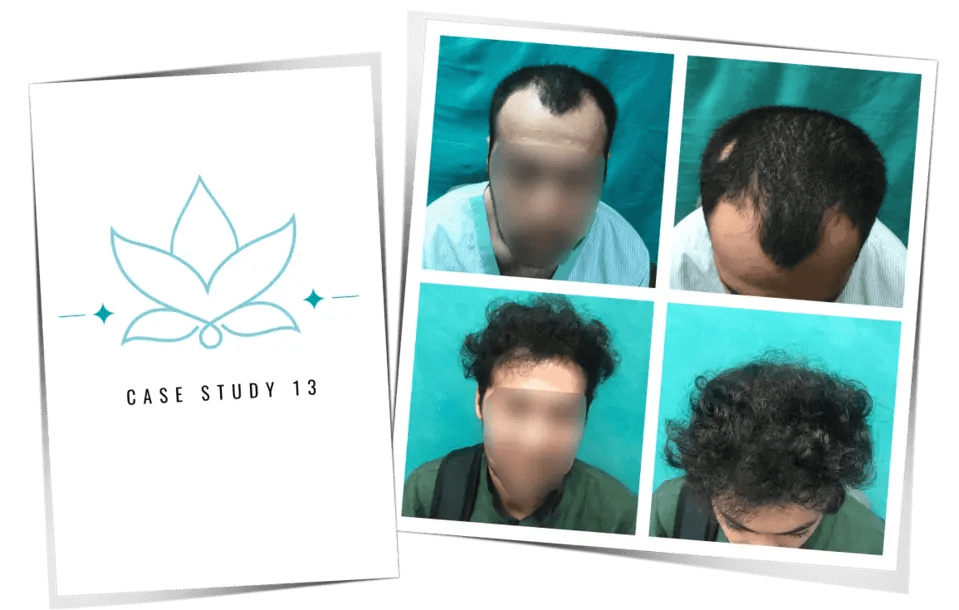 Patient case study