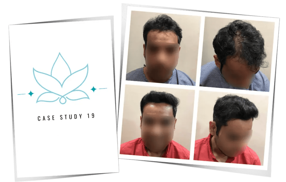 Patient case study